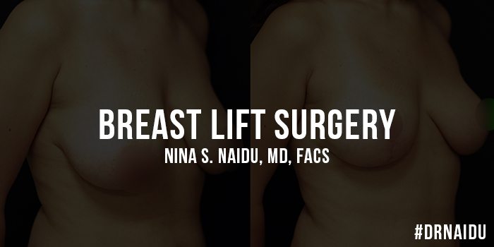 Cleavage Lift Surgery NYC l Boob Lift New York - Breast Enhancement
