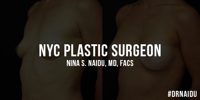 (c) Naiduplasticsurgery.com
